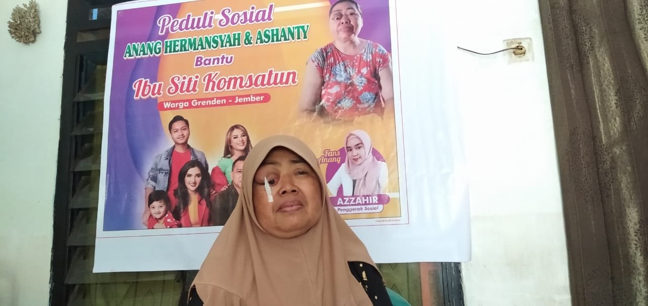 Penderita Sakit Mata Di Jember Mendapat Perhatian Anang Hermansyah